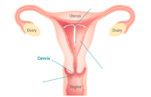 uterus